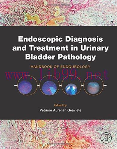 [AME]Endoscopic Diagnosis and Treatment in Urinary Bladder Pathology: Handbook of Endourology