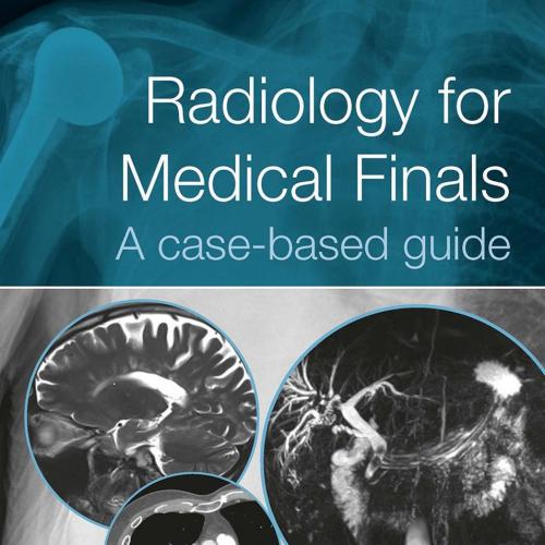 Radiology for Medical Finals A Case-based Guide