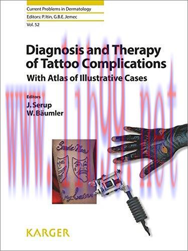 [AME]Diagnosis and Therapy of Tattoo Complications: With Atlas of Illustrative Cases (Current P...