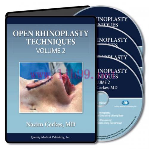[AME]QMP Open Rhinoplasty Techniques, Volume 2 2020 (Videos)
