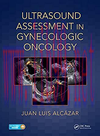 [PDF]Ultrasound Assessment in Gynecologic Oncology