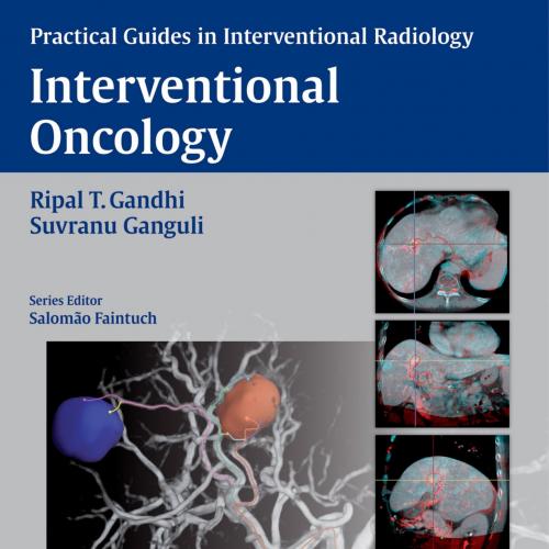Interventional Oncology Practical Guides in Interventional Radiology