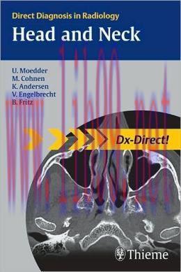 [AME]Head and Neck Imaging (Direct Diagnosis in Radiology)
