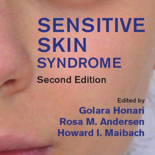 Sensitive Skin Syndrome Second Edition