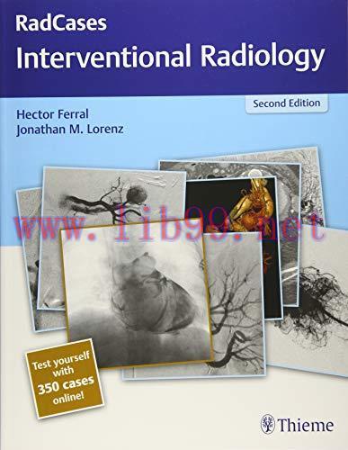[AME]RadCases Q&A Interventional Radiology, 2nd Edition (Original PDF)