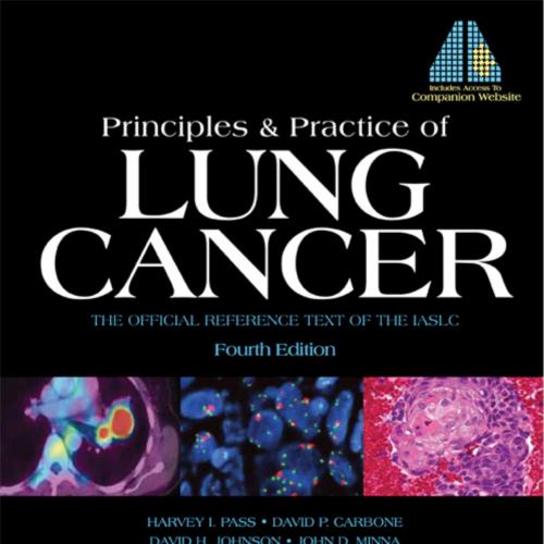 Principles and Practice of Lung Cancer, 4th Edition