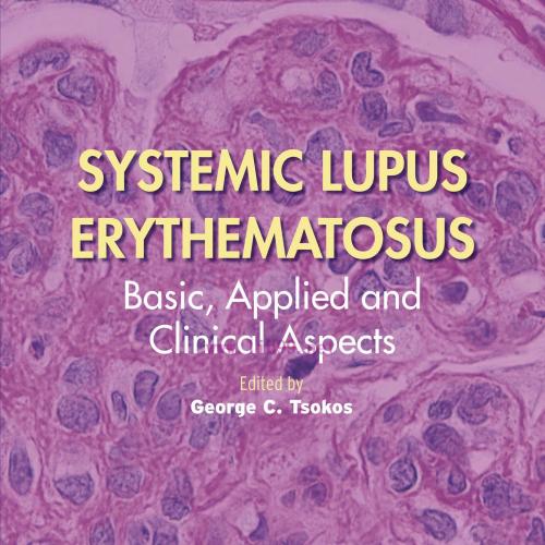 [AME]Systemic Lupus Erythematosus: Basic, Applied and Clinical Aspects, 2nd Edition (EPUB)