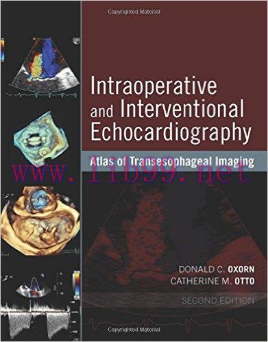 [AME]Intraoperative and Interventional Echocardiography: Atlas of Transesophageal Imaging, 2nd ...