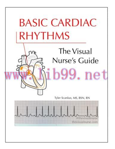 [AME]Basic Cardiac Rhythms: The Visual Nurse's Guide (The Visual Nurse's Basic ECG Series) (Azw...