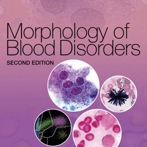 Morphology of Blood Disorders, 2nd Edition