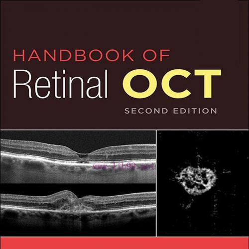 [AME]Handbook of Retinal OCT: Optical Coherence Tomography, 2nd Edition (EPUB)