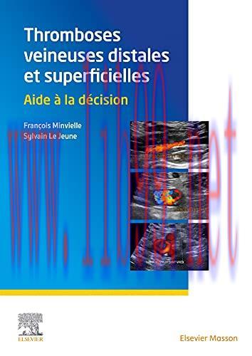 [AME]Thromboses veineuses distales et superficielles: Aide &agrave; la d&eacute;cision (French Edition) (Orig...