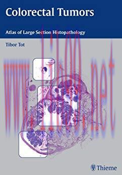 [PDF]Colorectal Tumors Atlas of Large Section Histopathology, 1e [Thieme] [2005]
