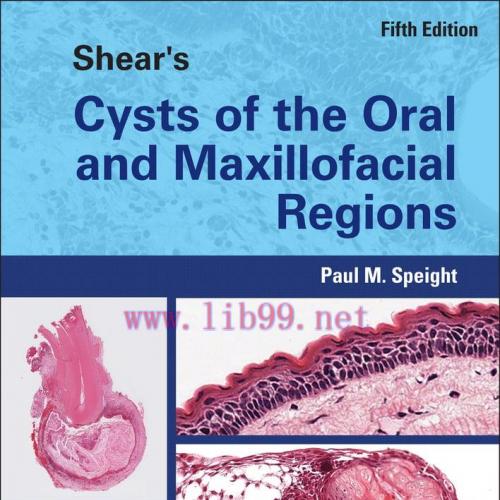 [AME]Shear's Cysts of the Oral and Maxillofacial Regions, 5th Edition (EPUB)