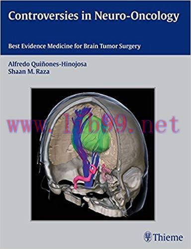 [PDF]Controversies in Neuro-Oncology