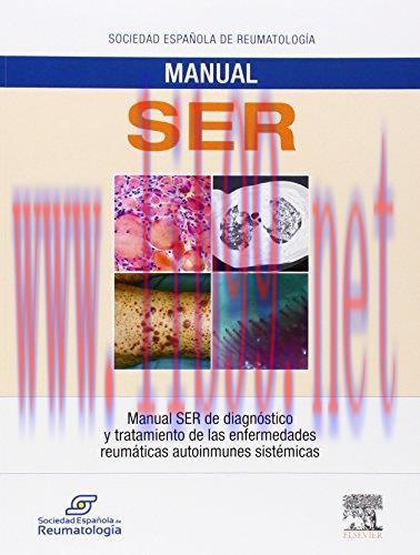 [AME]Manual SER de diagn&oacute;stico y tratamiento de las enfermedades reum&aacute;ticas autoinmunes sist&eacute;mi...