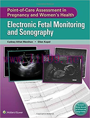 [PDF]Electronic Fetal Monitoring and Sonography