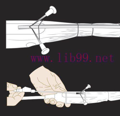 [AME]MRIOnline Imaging Mastery Series: Image-Guided Abscess Drainage in Interventional Radiolog...