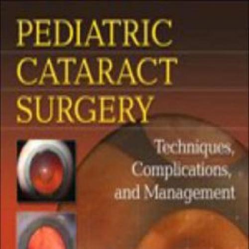 Pediatric Cataract Surgery-Techniques, Complications, and Management