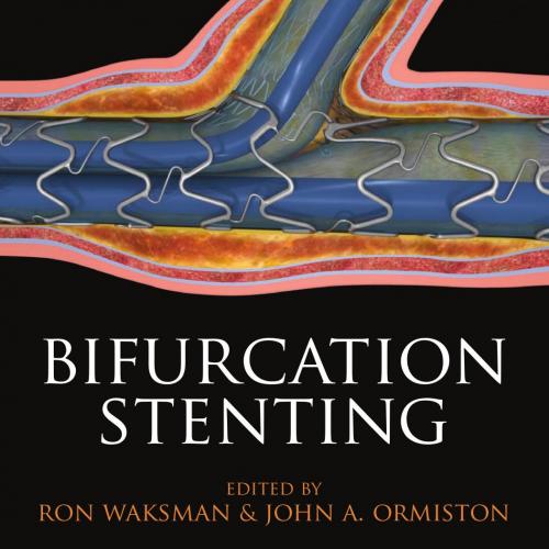 Essentials of Bifurcation Stenting - Ormiston, John A.(Author)