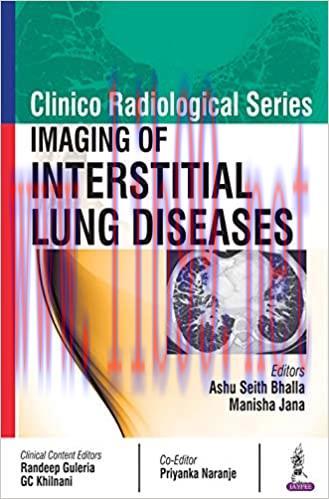 [AME]Imaging of Interstitial Lung Diseases (Clinico Radiological) (Original PDF)