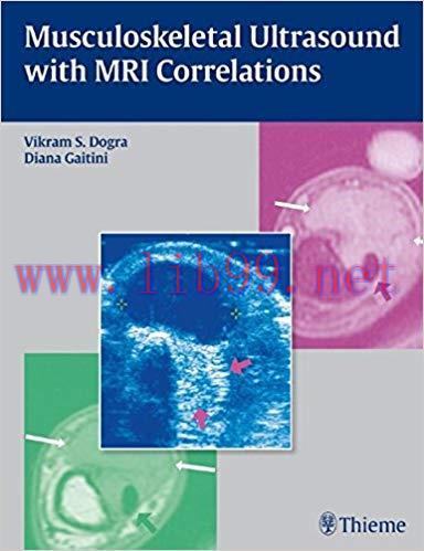 [PDF]Musculoskeletal Ultrasound with MRI Correlations