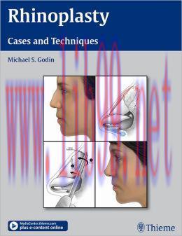 [AME]Rhinoplasty: Cases and Techniques (ORIGINAL PDF from_ Publisher)