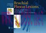 [PDF]Brachial Plexus Lesions: Drawings of Explorations and Reconstructions by Algimantas Otonas...