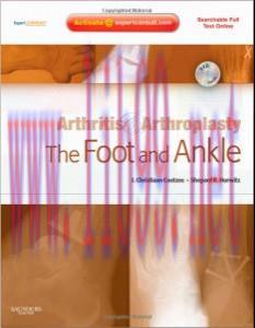 [AME]Arthritis and Arthroplasty: The Foot and Ankle: Expert Consult &ndash; Online, Print and DVD, 1e...