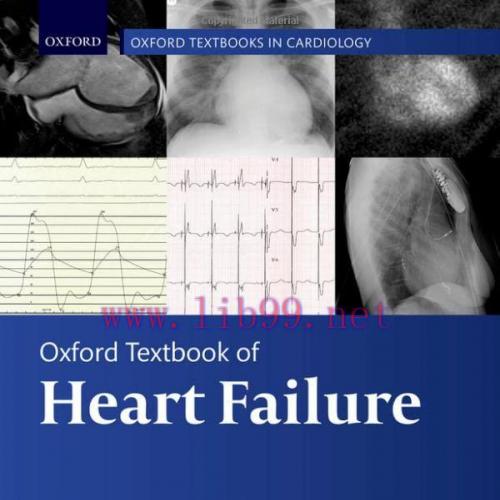 [AME]Oxford Textbook of Heart Failure, 2nd Edition (Oxford Textbooks in Cardiology) (Original P...