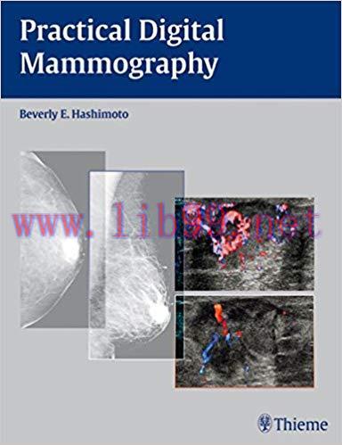 [PDF]Practical Digital Mammography