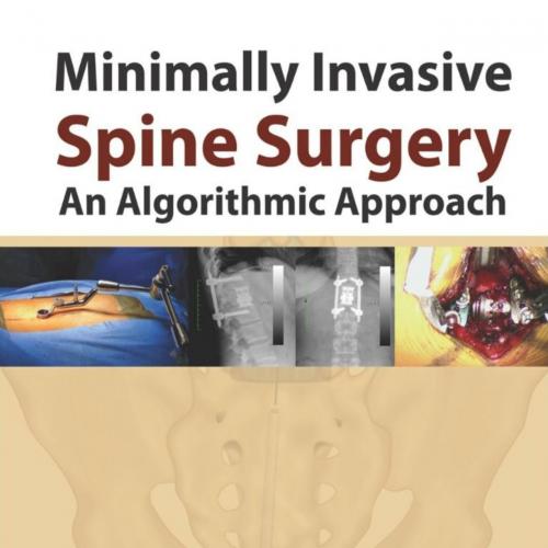 Minimally Invasive Spine Surgery An Algorithmic Approach 1th