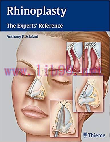 [PDF]Rhinoplasty: The Expert’s Reference