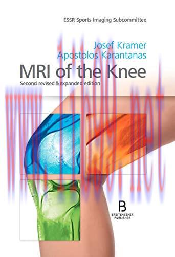 [AME]MRI of the Knee: Second revised & expanded edition (Original PDF)