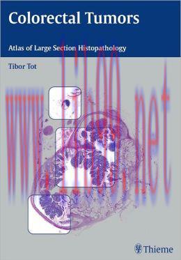 [AME]Colorectal Tumors: Atlas of Large Section Histopathology