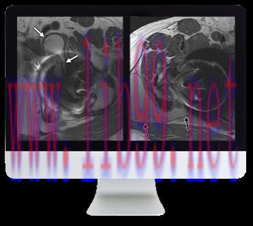 [AME]ARRS Controversies in Hip and Pelvis Imaging 2016 (CME VIDEOS)