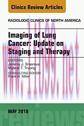 [PDF]Lung Cancer, An Issue of Radiologic Clinics of North America, E-Book