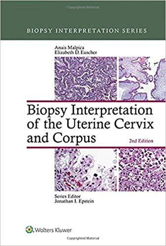 Biopsy Interpretation of the Uterine Cervix and Corpus, 2nd Edition