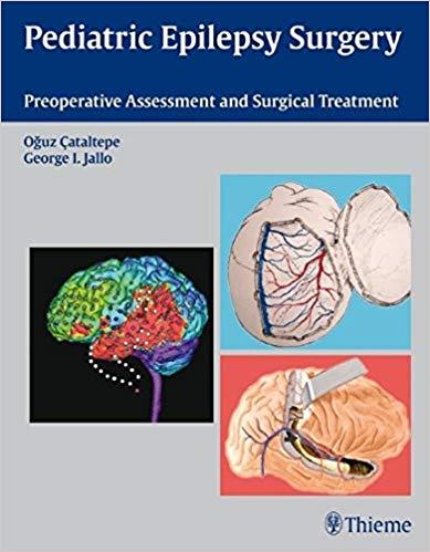 Pediatric Epilepsy Surgery Preoperative Assessment and Surgical Treatment
