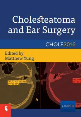 Cholesteatoma and Ear Surgery