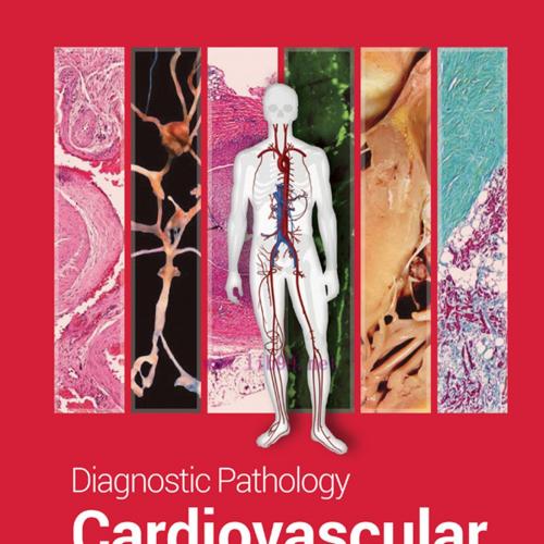 [AME]Diagnostic Pathology: Cardiovascular, 3rd Edition (EPUB)