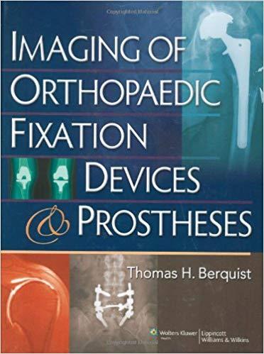 Imaging of Orthopaedic Fixation Devices and Prostheses