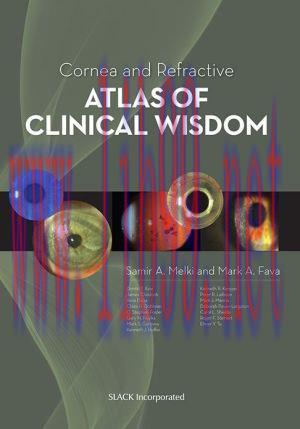 [AME]Cornea and Refractive Atlas of Clinical Wisdom (PDF)