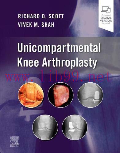 [AME]Unicompartmental Knee Arthroplasty (Original PDF)
