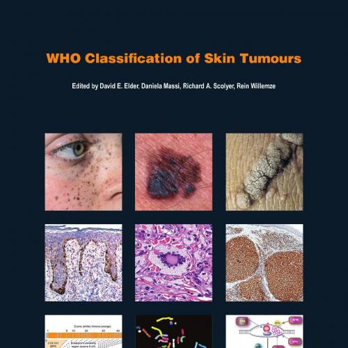 WHO Classification of Skin Tumours