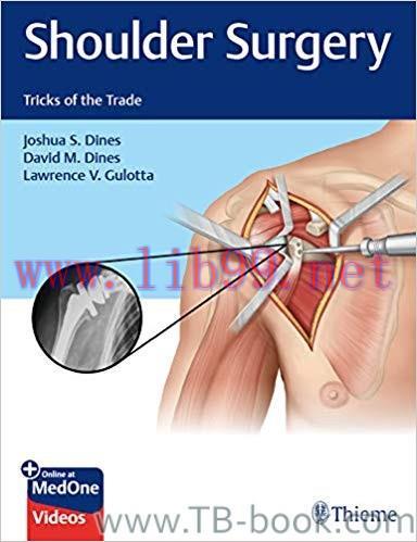 Shoulder Surgery: Tricks of the Trade 1st Edition by Joshua S. Dines