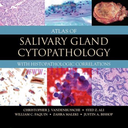[AME]Atlas of Salivary Gland Cytopathology: with Histopathologic Correlations (EPUB)