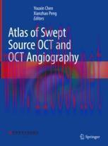 [PDF]Atlas of Swept Source OCT and OCT Angiography