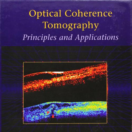 Optical Coherence Tomography: Principles and Applications 1st Edition