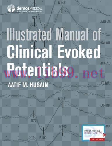 [AME]Illustrated Manual of Clinical Evoked Potentials (PDF)
